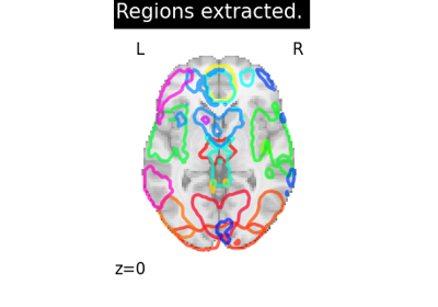 Regions Extraction of Default Mode Networks using Smith Atlas