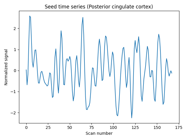Seed time series (Posterior cingulate cortex)