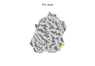 Seed-based connectivity on the surface