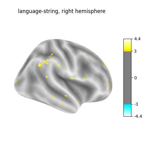 language-string, right hemisphere