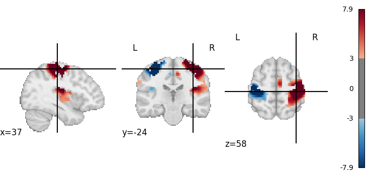 plot 3d and 4d niimg