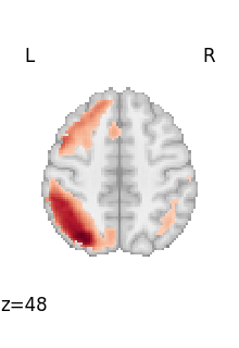plot 3d and 4d niimg