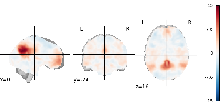 plot 3d and 4d niimg