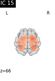 plot compare decomposition