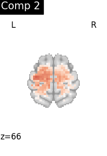 plot compare decomposition