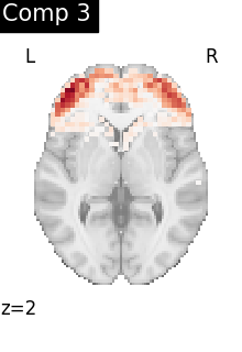 plot compare decomposition