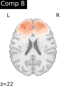 plot compare decomposition