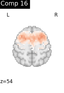 plot compare decomposition