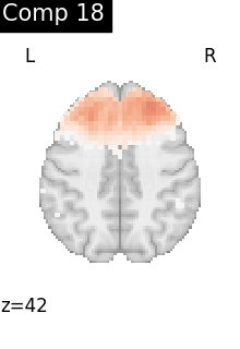 plot compare decomposition
