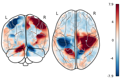 plot demo glass brain extensive