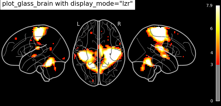 plot demo glass brain extensive