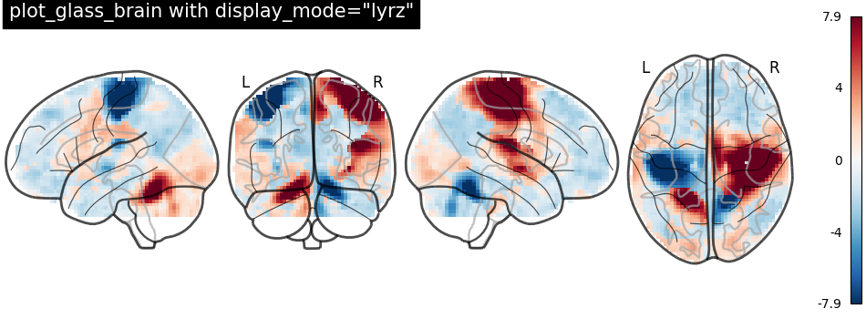 plot demo glass brain extensive