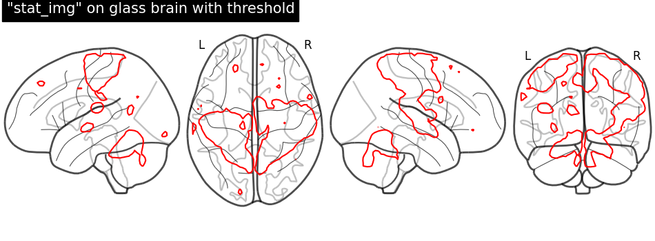 plot demo glass brain extensive