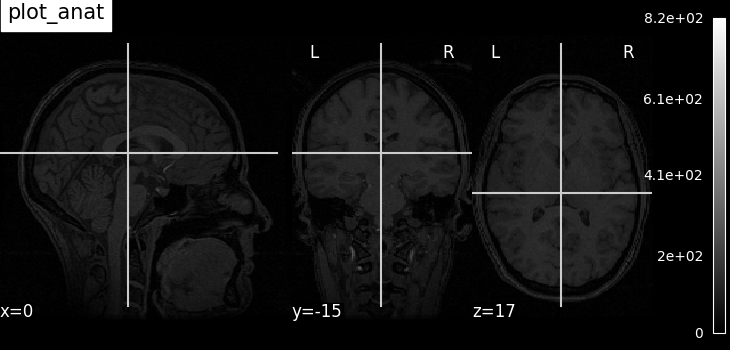 plot_anat