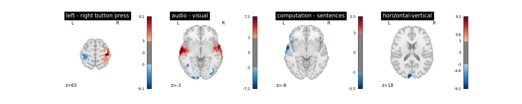 plot first level details