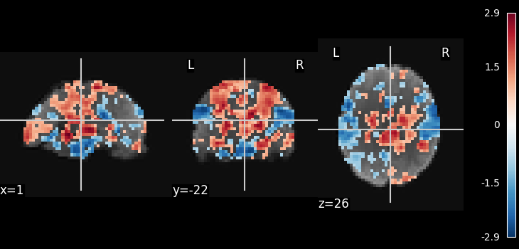 plot ica resting state