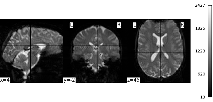 plot single subject single run