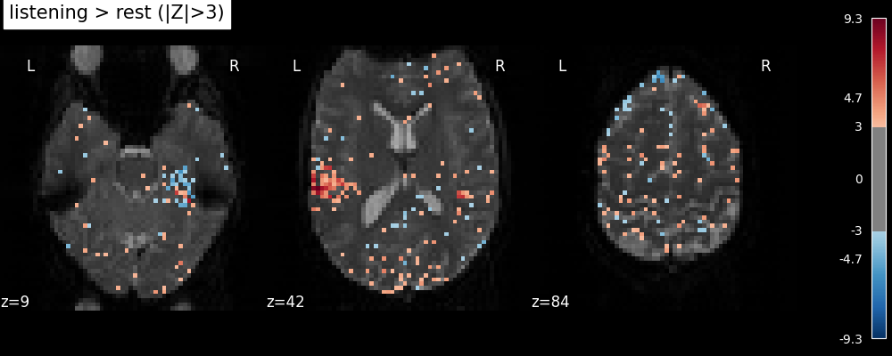 plot single subject single run