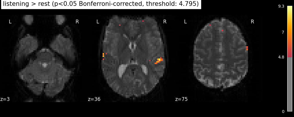 plot single subject single run