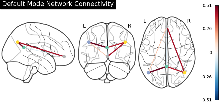 plot sphere based connectome
