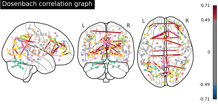 plot sphere based connectome