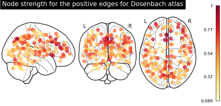 plot sphere based connectome