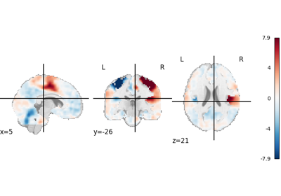3D and 4D niimgs: handling and visualizing