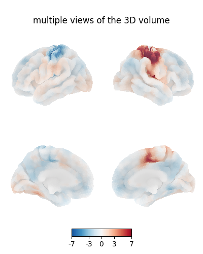 multiple views of the 3D volume