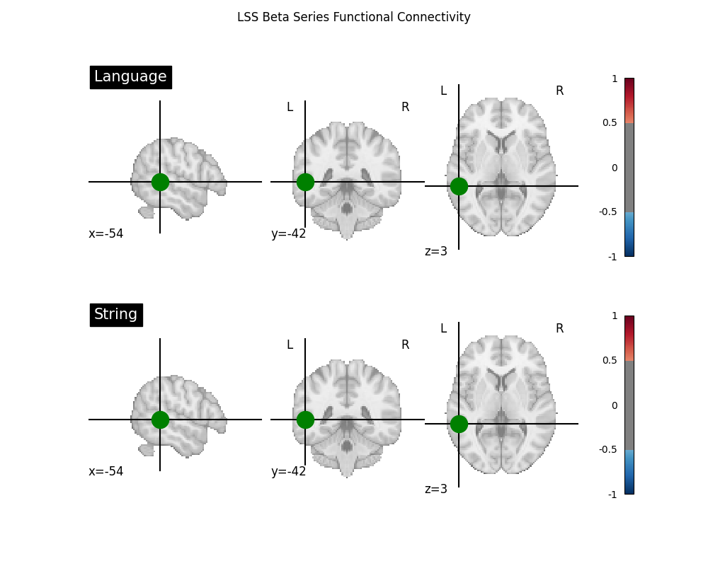 LSS Beta Series Functional Connectivity
