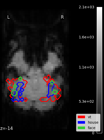 ../_images/sphx_glr_plot_haxby_masks_001.png