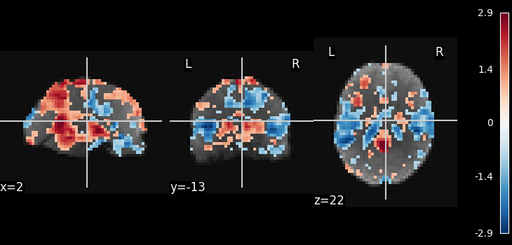 plot ica resting state