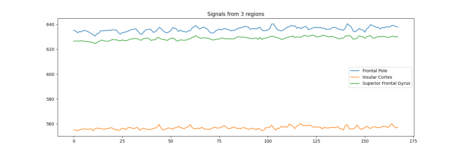 Signals from 3 regions