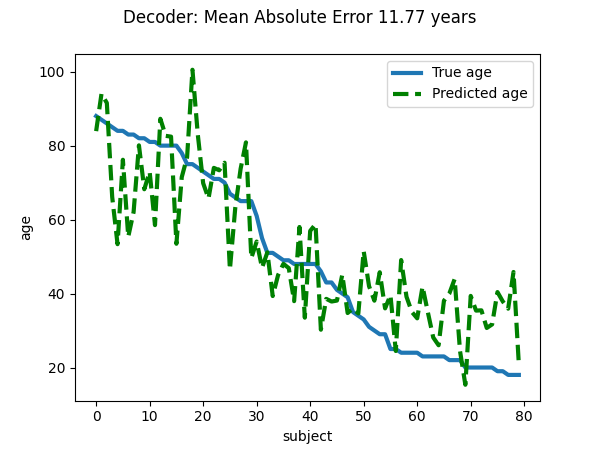 _images/sphx_glr_plot_oasis_vbm_002.png
