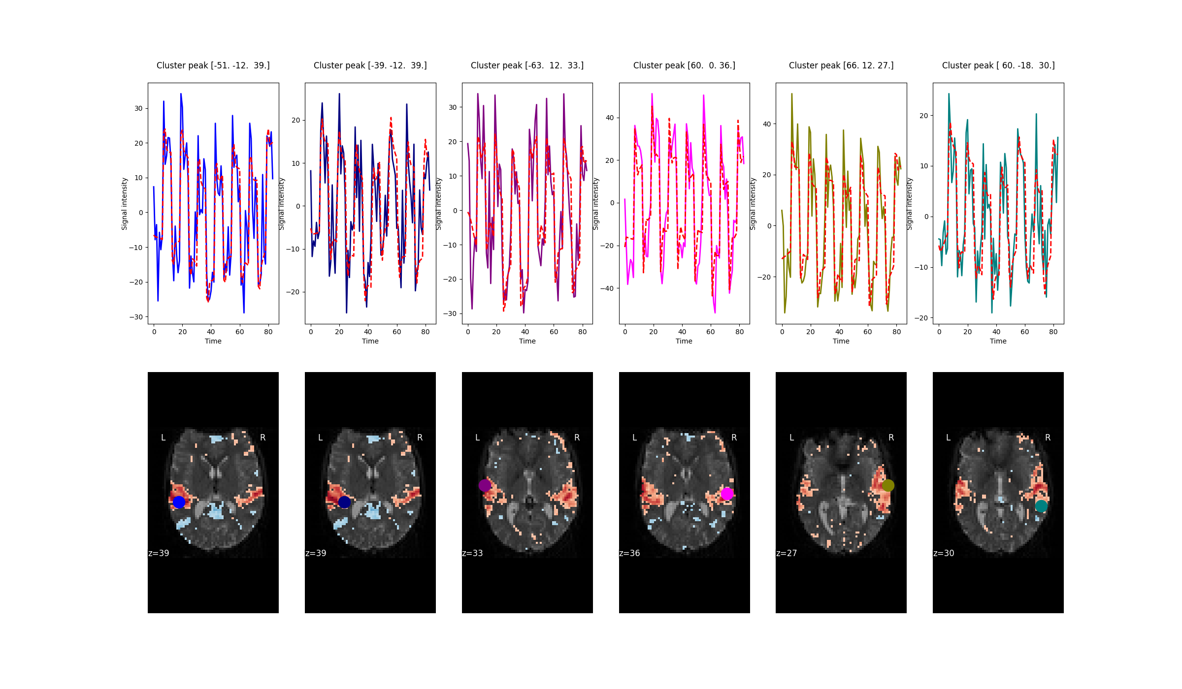Cluster peak [-51. -12.  39.] , Cluster peak [-39. -12.  39.] , Cluster peak [-63.  12.  33.] , Cluster peak [60.  0. 36.] , Cluster peak [66. 12. 27.] , Cluster peak [ 60. -18.  30.]