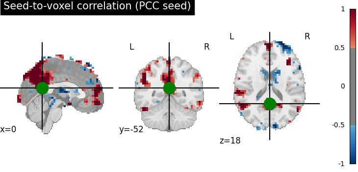 plot seed to voxel correlation