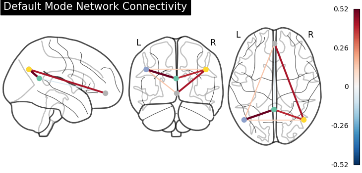 plot sphere based connectome