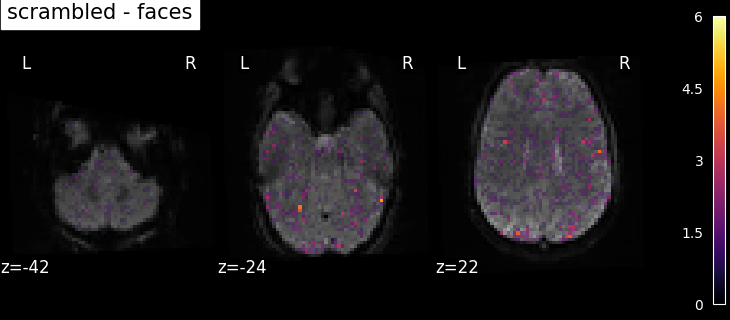 plot spm multimodal faces