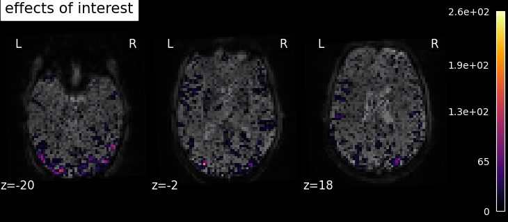 plot spm multimodal faces