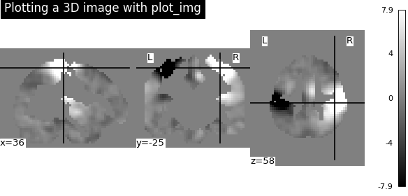 ../../_images/nilearn-plotting-plot_img-1.png