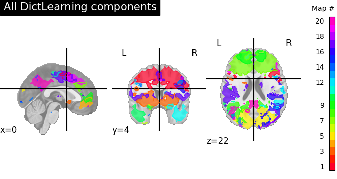 plot compare decomposition