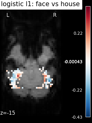 ../_images/sphx_glr_plot_haxby_different_estimators_002.png