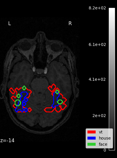 ../_images/sphx_glr_plot_haxby_masks_001.png