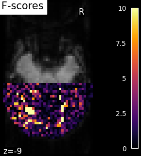 ../_images/sphx_glr_plot_haxby_searchlight_002.png
