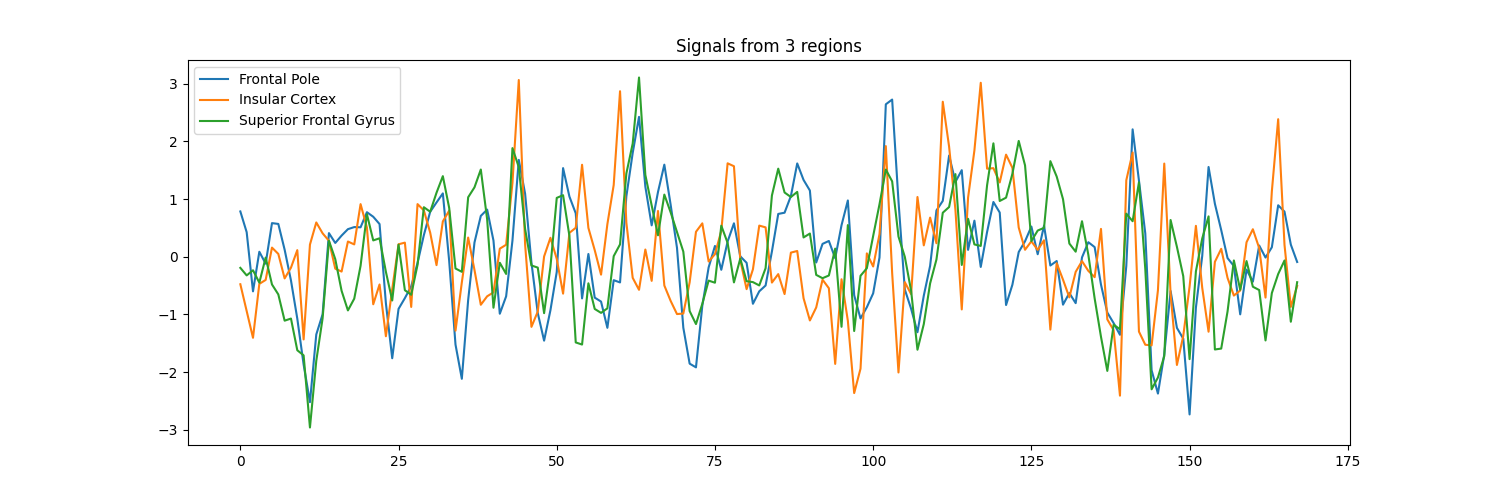 Signals from 3 regions