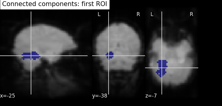 plot roi extraction