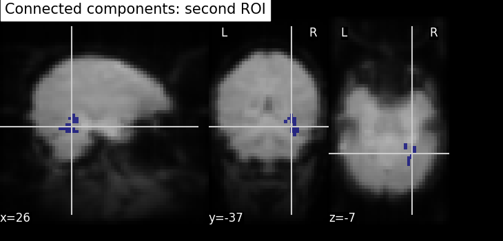 plot roi extraction