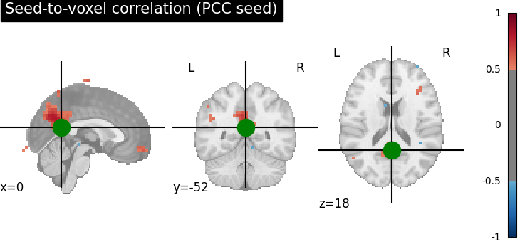 plot seed to voxel correlation