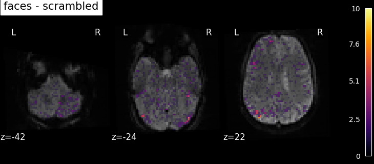 ../_images/sphx_glr_plot_spm_multimodal_faces_002.png