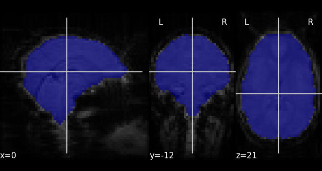 plot visualization