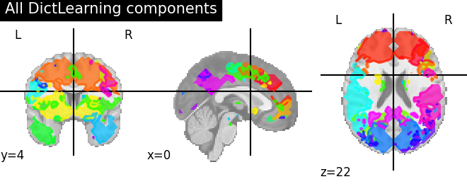 ../_images/sphx_glr_plot_compare_decomposition_022.png